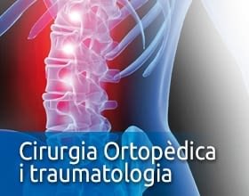 Cirurgia Ortopèdica i Traumatologia