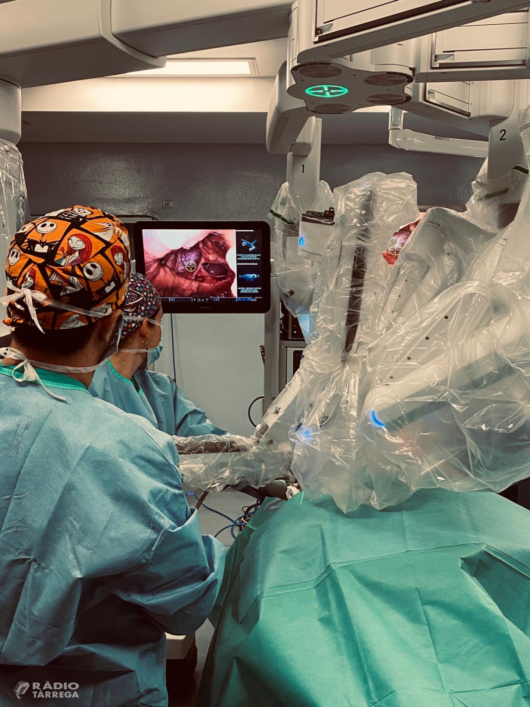 L'Hospital Arnau de Vilanova de Lleida preveu doblar l'activitat quirúrgica robòtica amb un segon robot Da Vinci