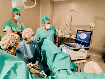L'Arnau de Vilanova incorpora la radiofreqüència com a nova tècnica per tractar miomes uterins