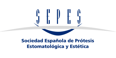 SEPES