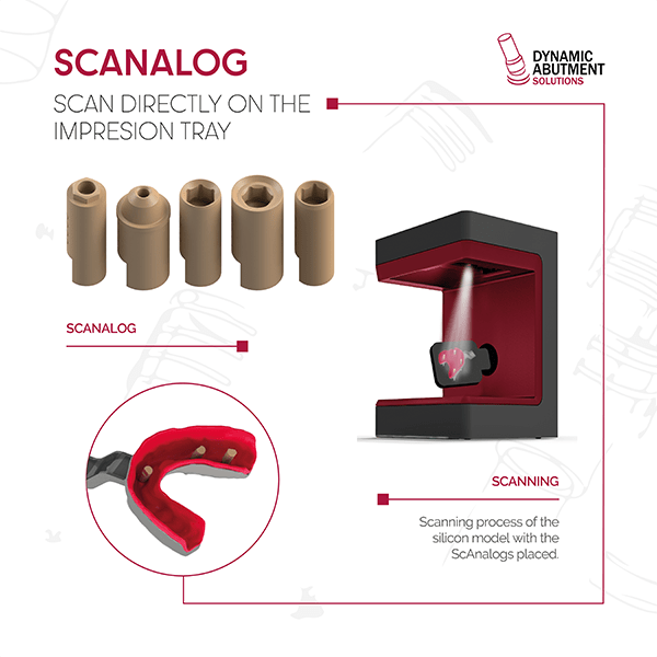 ScAnalog: Digitaliza la posición de los implantes